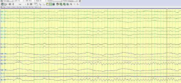 Figure 2a