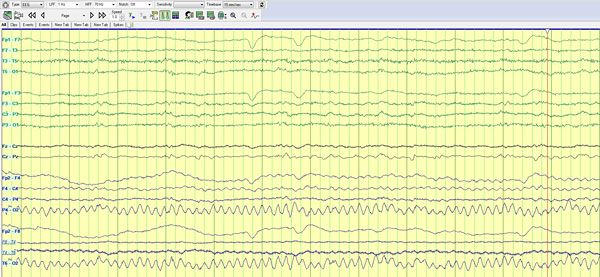 Figure 2b