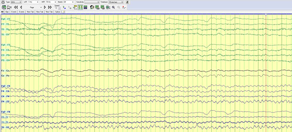 Figure 2c