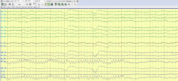 Figure 2d